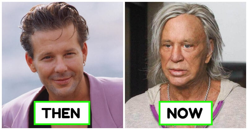 30 Celebrities Who Have Aged So Badly That We Can