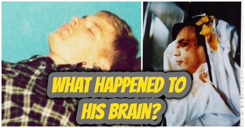 Jeffrey Dahmer Autopsy Prison: What Happened To His Brain?
