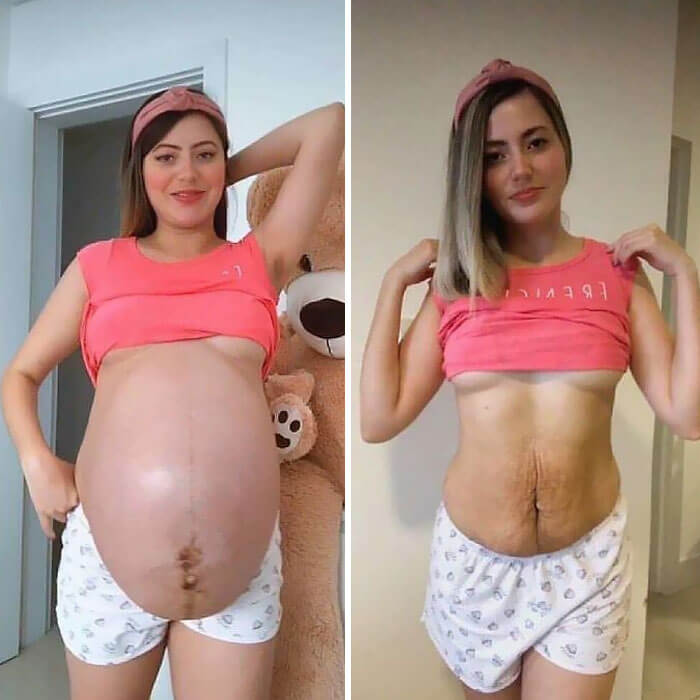 Women's Experiences During Pregnancy