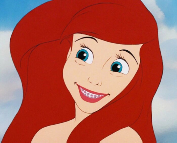 Ariel Princesses Wear Braces