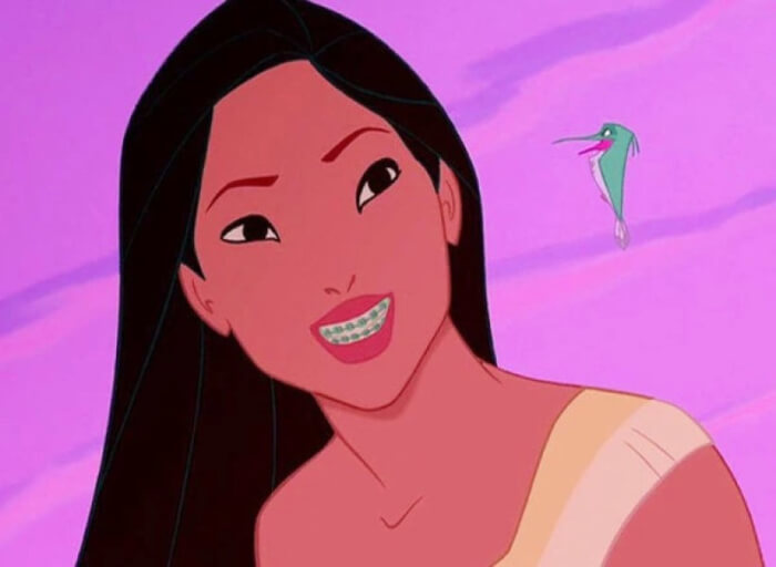 Pocahontas Wear Braces