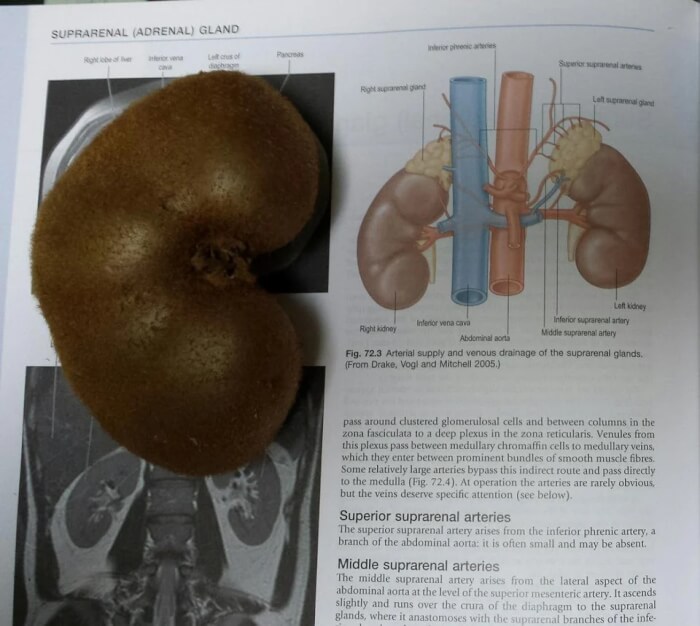 This kiwi looks like a kidney