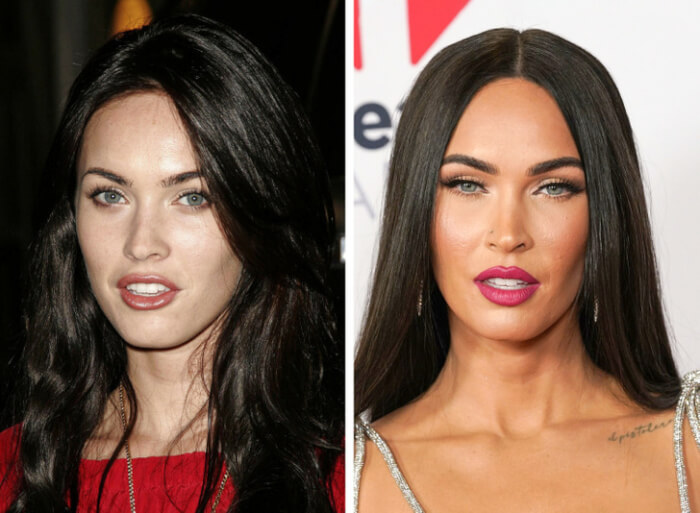 Dramatic Changes Of Celebrities