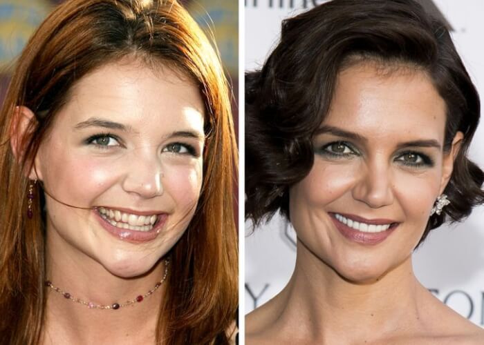 Celebrities Who Changed Their Teeth, Katie Holmes