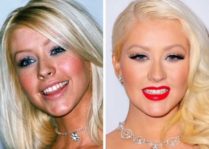 Celebrities Who Changed Their Teeth, Christina Aguilera