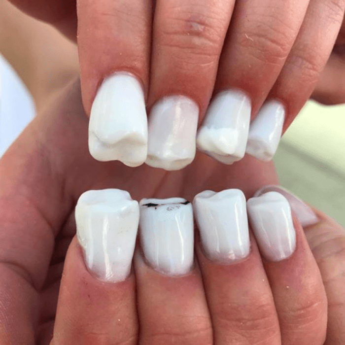 Teeth Nails