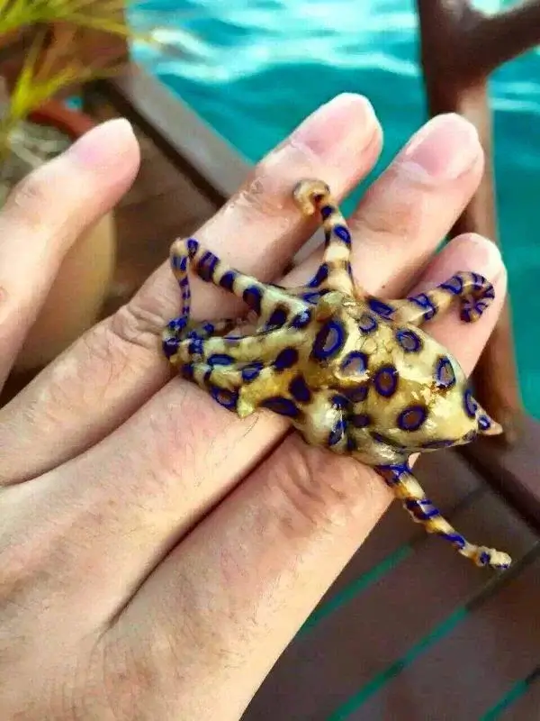 Poisoned By A Blue-Ringed Octopus
