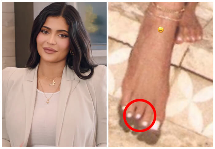 celebrities with strange body features Kylie Jenner Has Strange Middle Toes