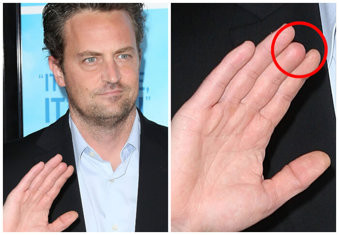 celebrities with strange body features Matthew Perry's Middle Finger