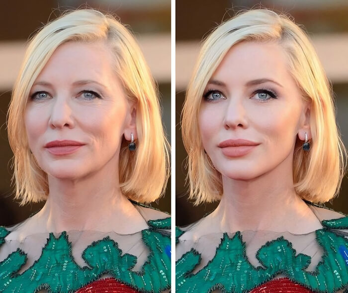 celebrities with unique facial features Cate Blanchett