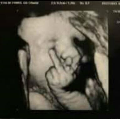 Funny Ultrasound Pictures 1