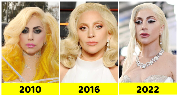 Celebs Who Were Stunning Then Lady Gaga