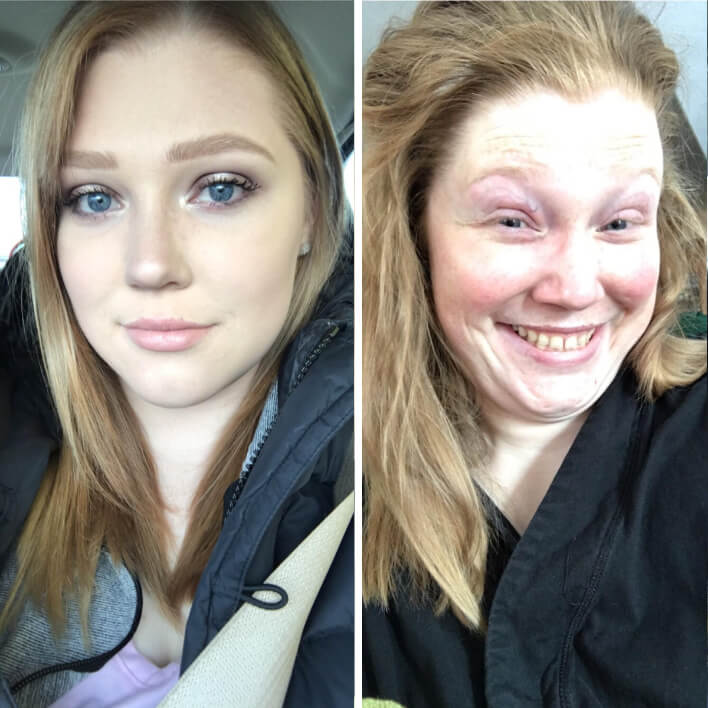 Before And After Snaps