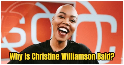 No More Photos Of Christine Williamson With Hair? Why Is She Bald - Revealed!