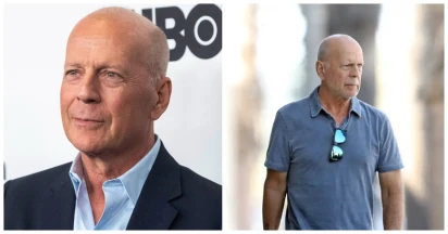 Concerns Mount As Hollywood Icon Bruce Willis Battles Aphasia And Frontotemporal Dementia