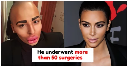 10 Crazy Fans Who Went Through Numerous Procedures To Resemble Their Favorite Celebrities