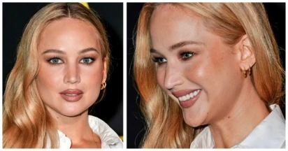 What Happened To Her Face? Controversy Erupts Over Jennifer Lawrence