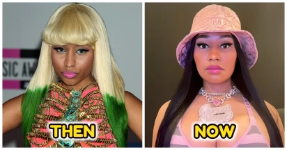 Nicki Minaj Opens Up About Plastic Surgery Regrets After Looking At Her Old Photos