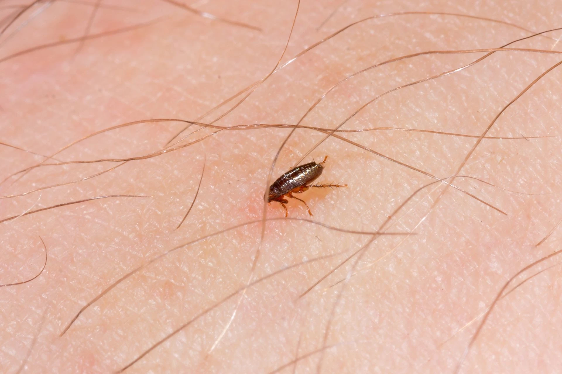 can humans get fleas - can fleas live on humans