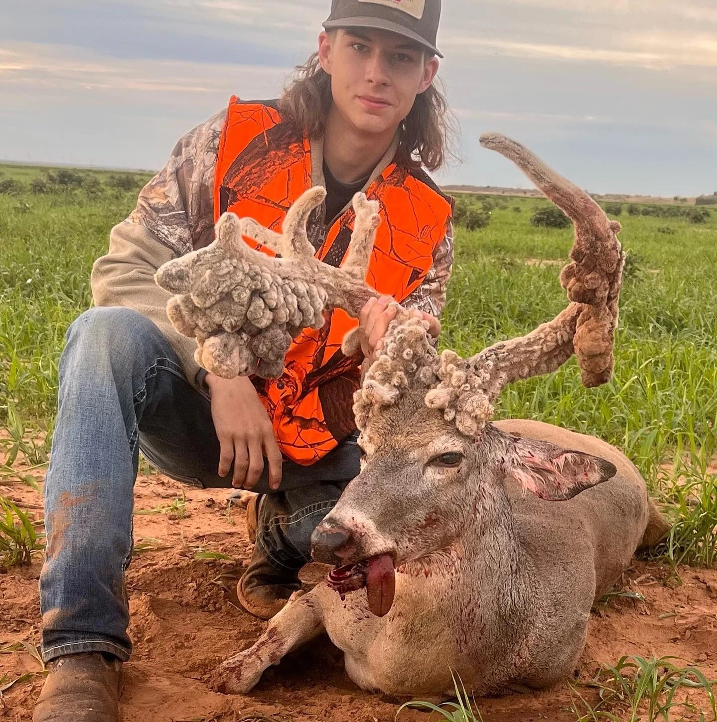 Teen Hunter Encountered A Truly Extraordinary Deer