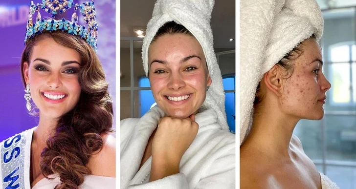 Rolene Strauss