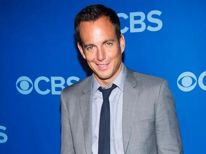 Is There a Wig in the Picture? - will arnett hairline