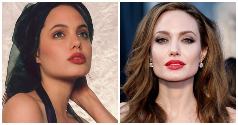 Before And After The 7 Best Celebrity Lips According To Top Plastic Surgeons 