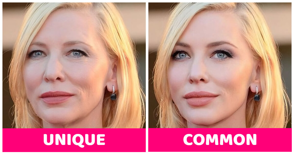 15-celebrities-with-unique-facial-features-when-they-followed-common